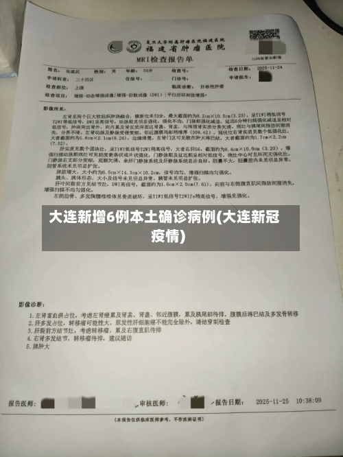 大连新增6例本土确诊病例(大连新冠疫情)