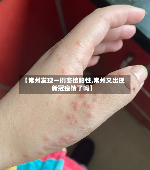 【常州发现一例密接阳性,常州又出现新冠疫情了吗】-第2张图片