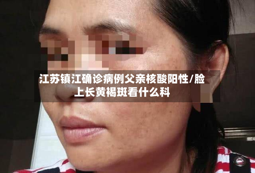 江苏镇江确诊病例父亲核酸阳性/脸上长黄褐斑看什么科