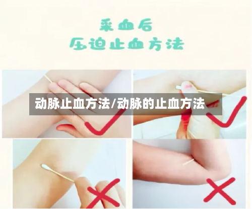 动脉止血方法/动脉的止血方法-第2张图片