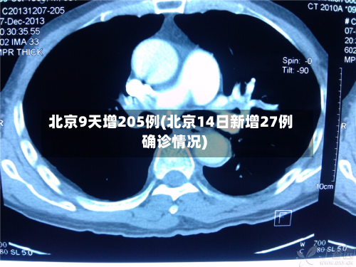 北京9天增205例(北京14日新增27例确诊情况)